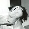 Injured child