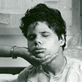 Injured child