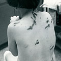Injured child